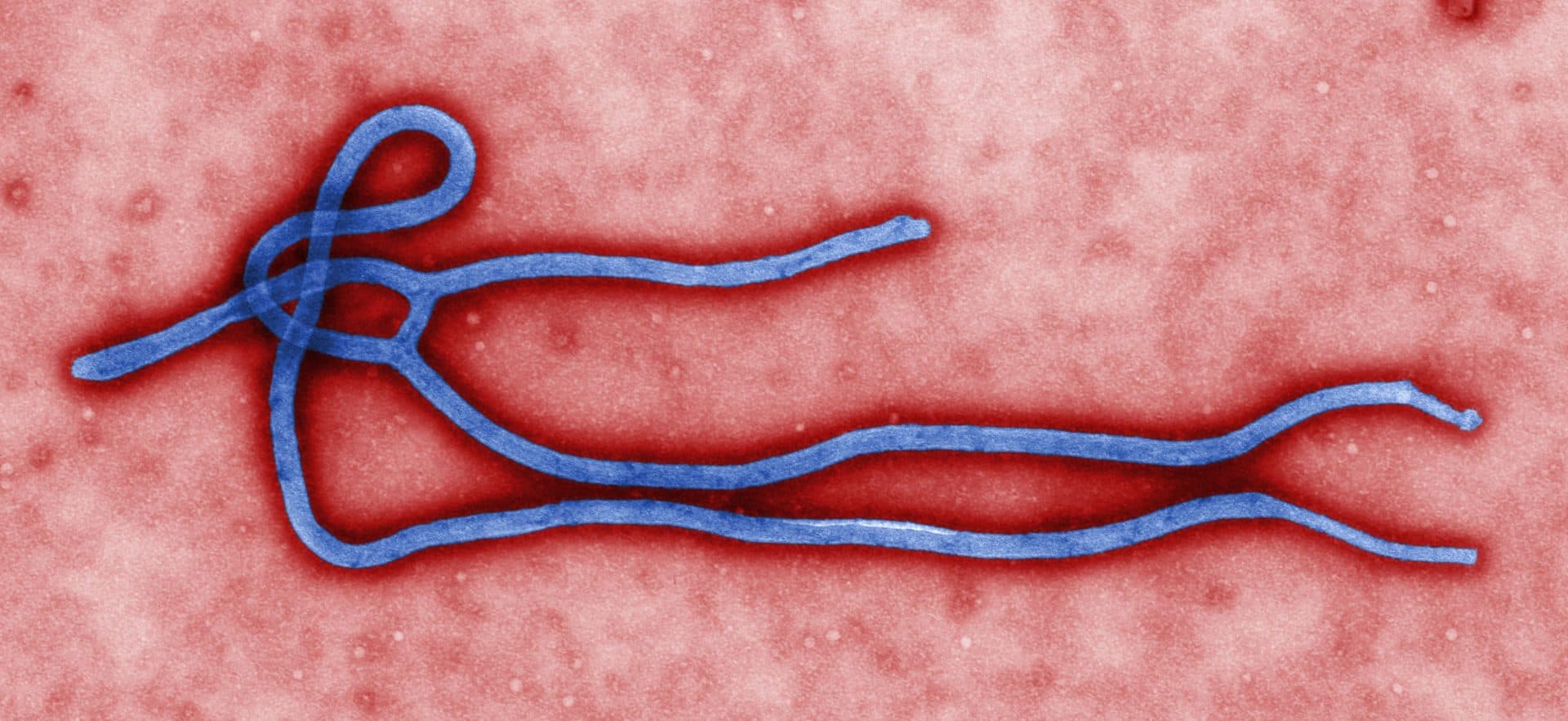 FOT_Ebola